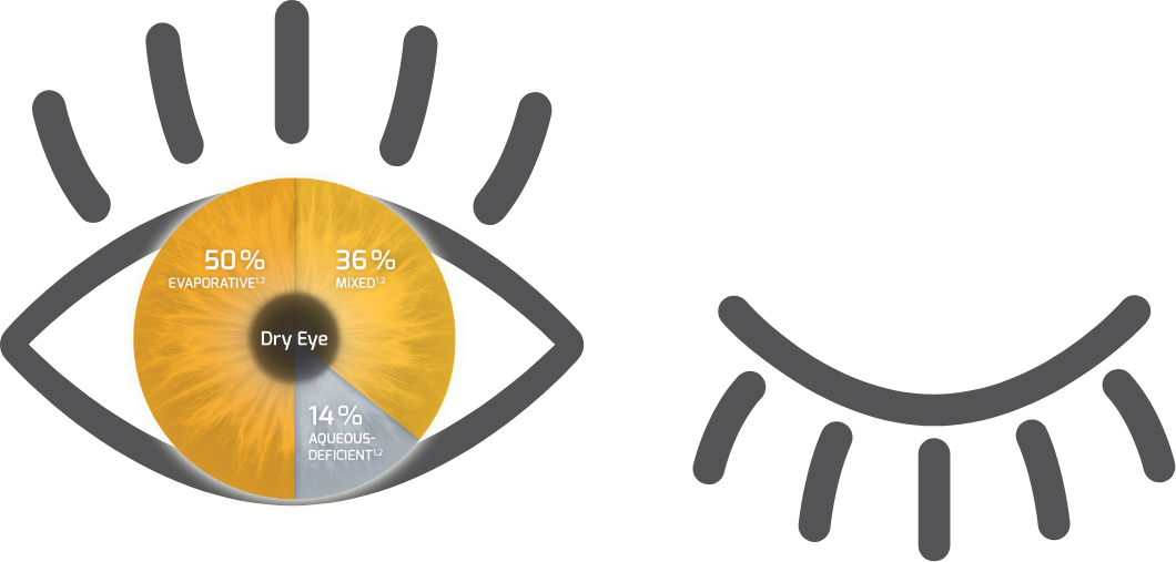 Eye Classification